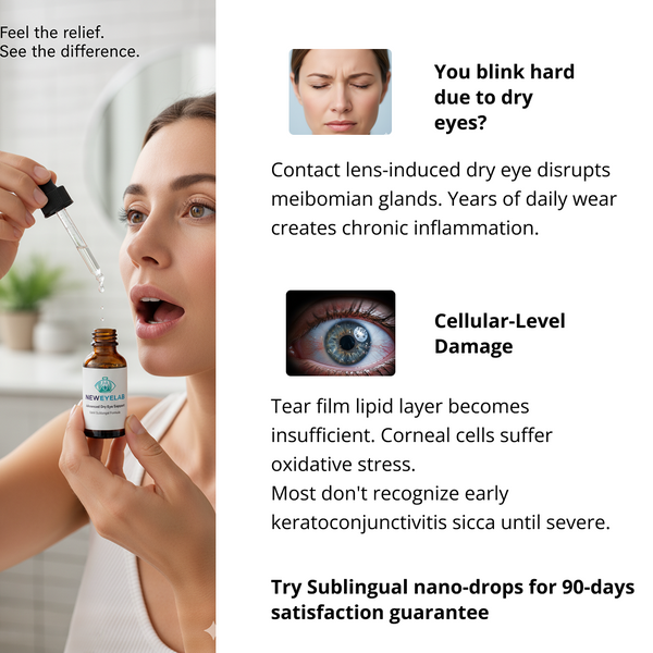 No More Dry Contact Lenses - Sublingual Eye Support